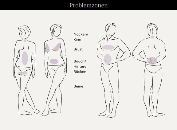 Grafik Problemzonen, Schönheitschirurgie in Hamburg, Dr. med. Alaleh Jamshidi